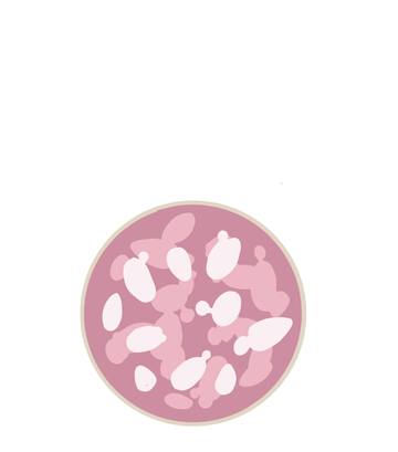 Lactobacillus casei
