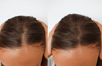 Before and after image showcasing hair improvement with Iconique Collagène treatment.